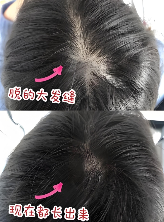 洗发水哪个牌子最好用最安全？洗发水畅销榜推荐！防脱固发表现突出