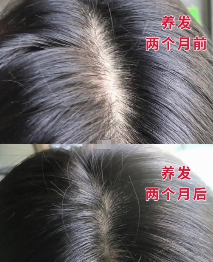 洗发水哪个牌子最好用最安全？洗发水畅销榜推荐！防脱固发表现突出