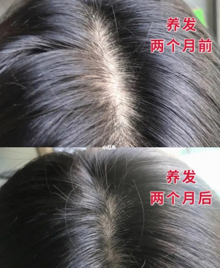 洗发水排行榜口碑最好十大洗发水!防脱生发效果值得推荐