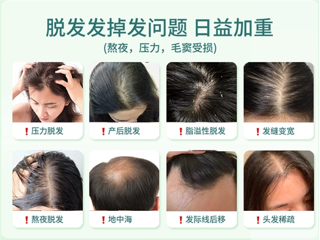 洗发水排行榜口碑最好十大洗发水!防脱生发效果值得推荐