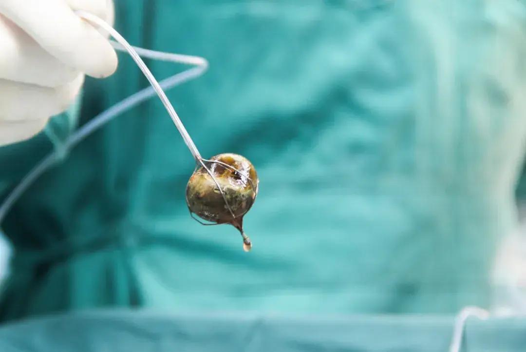 1756257365560650.jpeg b218271064b248e0a01fe68b03cdabe6_tplv-tt-origin-web_gif.jpeg